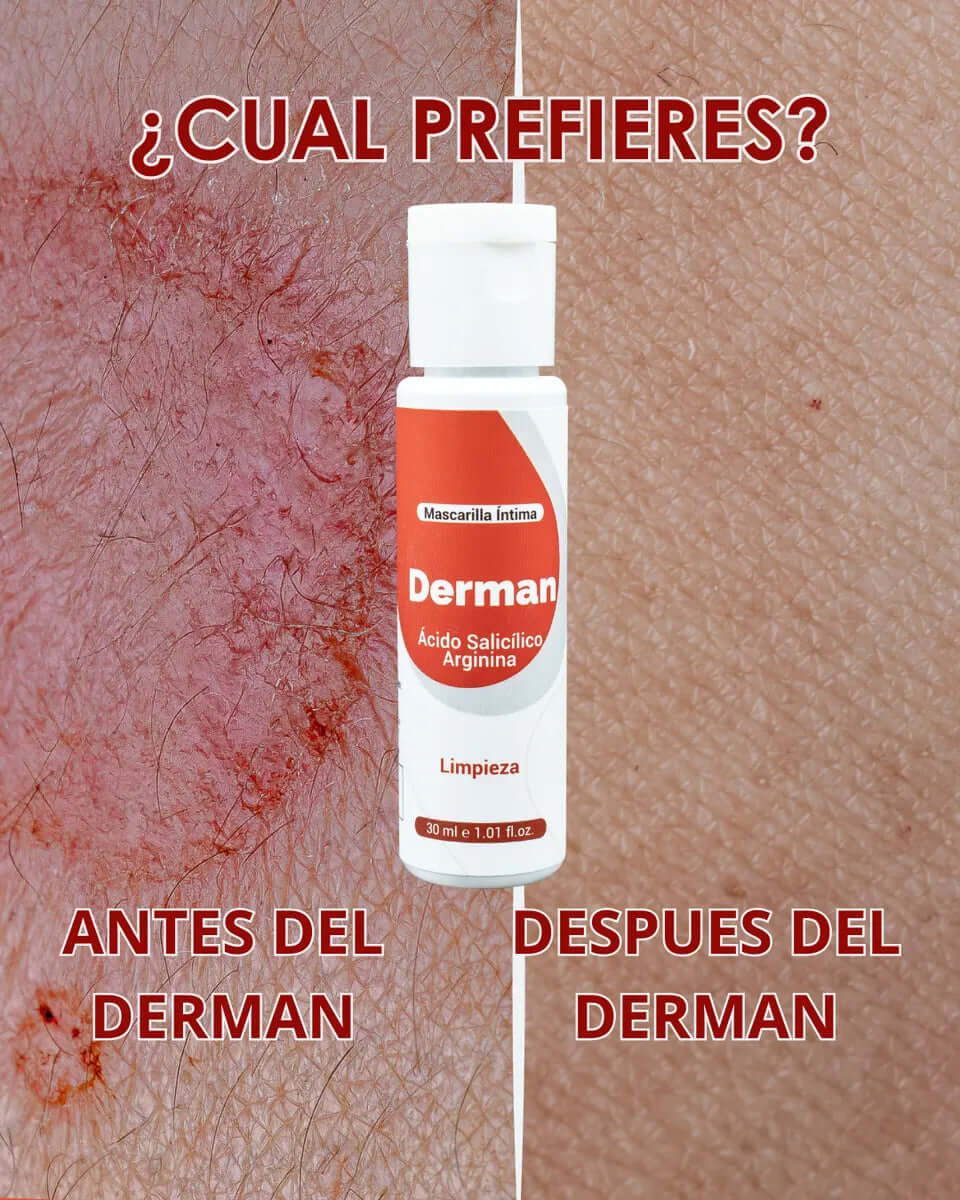 Textura cremosa de Derman crema íntima para una aplicación suave