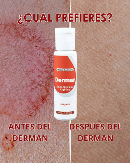derman-crema-intima-hidratante-